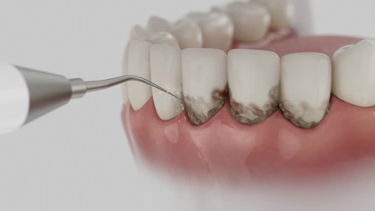 Reliable Emergency Dentist contractor in Whiting, IN by Smile Center Dentistry